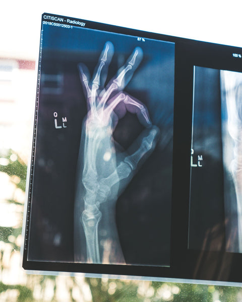 x-ray of the okay hand signal